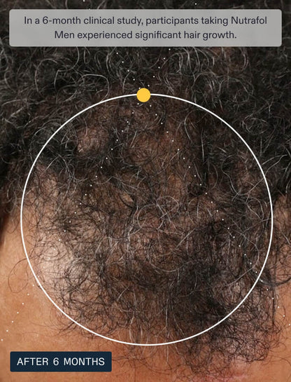 Nutrafol Men's Hair Growth Supplements, Clinically Tested for Visibly Thicker Hair and Scalp Coverage, Dermatologist Recommended - 1 Month Supply